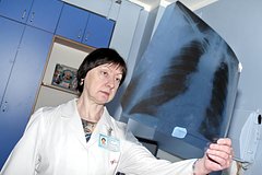 Россиянам перечислили главные симптомы пневмонии